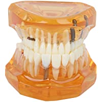 Modelo de dientes estándar- suministros de estudio de enseñanza dental para niños extraíbles- modelo de dientes de…